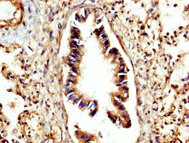 CTSC / Cathepsin C / JP Antibody - Immunohistochemistry image at a dilution of 1:300 and staining in paraffin-embedded human lung tissue performed on a Leica BondTM system. After dewaxing and hydration, antigen retrieval was mediated by high pressure in a citrate buffer (pH 6.0) . Section was blocked with 10% normal goat serum 30min at RT. Then primary antibody (1% BSA) was incubated at 4 °C overnight. The primary is detected by a biotinylated secondary antibody and visualized using an HRP conjugated SP system.