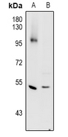 CTSC / Cathepsin C / JP Antibody - Western blot analysis of Cathepsin C HC expression in H9C2 (A), PC3 (B) whole cell lysates.