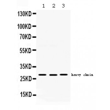 CTSD / Cathepsin D Antibody - Western blot analysis of Cathepsin D expression in HEPG2 whole cell lysates (lane 1), A549 whole cell lysates (lane 2) and PANC whole cell lysates (lane 3). Cathepsin D at 28 kD was detected using rabbit anti- Cathepsin D Antigen Affinity purified polyclonal antibody at 0.5 ug/mL. The blot was developed using chemiluminescence (ECL) method.