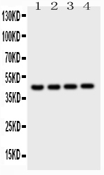 CTSD / Cathepsin D Antibody - Western blot - Anti-Cathepsin D Picoband Antibody