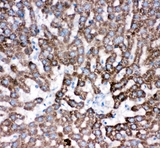 CTSD / Cathepsin D Antibody - IHC analysis of Cathepsin D using anti-Cathepsin D antibody. Cathepsin D was detected in paraffin-embedded section of rat liver tissues. Heat mediated antigen retrieval was performed in citrate buffer (pH6, epitope retrieval solution) for 20 mins. The tissue section was blocked with 10% goat serum. The tissue section was then incubated with 1µg/ml rabbit anti-Cathepsin D Antibody overnight at 4°C. Biotinylated goat anti-rabbit IgG was used as secondary antibody and incubated for 30 minutes at 37°C. The tissue section was developed using Strepavidin-Biotin-Complex (SABC) with DAB as the chromogen.