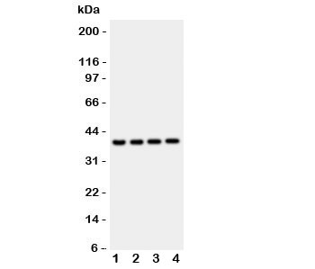 CTSD / Cathepsin D Antibody - Western blot testing of Cathepsin D antibody and mouse samples: 1: liver; 2: brain; 3: thymus; 4: Neuro-2a lysate. Predicted molecular weight: 43-46 kDa and 28/15 kDa heavy/light chain.