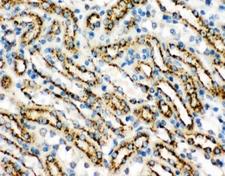 CTSD / Cathepsin D Antibody - IHC-P: Cathepsin D antibody testing of mouse kidney tissue