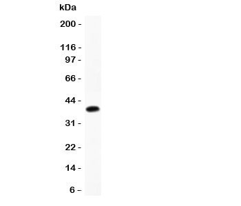 CTSD / Cathepsin D Antibody - Western blot testing of Cathepsin D antibody and recombinant human protein (0.5ng)
