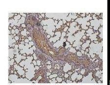CTSD / Cathepsin D Antibody - Immunohistochemistry of polyclonal antibody to C1SD (1:200) on paraformaldehyde-fixed paraffin-embedded mouse lung.