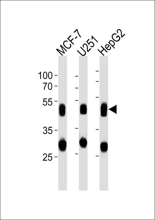 CTSD / Cathepsin D Antibody - CTSD Antibody western blot of MCF-7,U251,HepG2 cell line lysates (35 ug/lane). The CTSD antibody detected the CTSD protein (arrow).