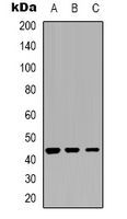 CTSD / Cathepsin D Antibody - Western blot analysis of Cathepsin D expression in MCF7 (A); HeLa (B); K562 (C) whole cell lysates.
