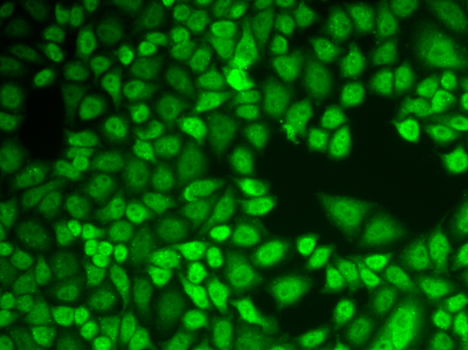 CTSD / Cathepsin D Antibody - Immunofluorescence analysis of HeLa cells.