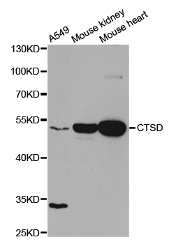 CTSD / Cathepsin D Antibody - Western blot analysis of extracts of various cell lines, using CTSD antibody at 1:1000 dilution. The secondary antibody used was an HRP Goat Anti-Rabbit IgG (H+L) at 1:10000 dilution. Lysates were loaded 25ug per lane and 3% nonfat dry milk in TBST was used for blocking.