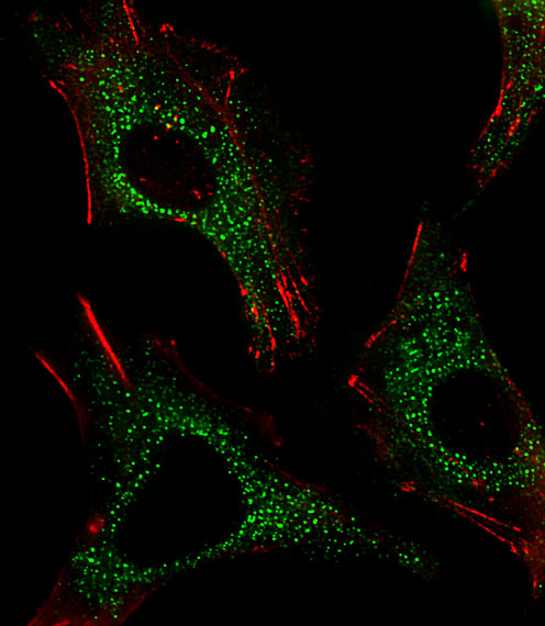 CTSD / Cathepsin D Antibody - Fluorescent image of HepG2 cells stained with CTSD. Antibody was diluted at 1:25 dilution. An Alexa Fluor 488-conjugated goat anti-rabbit lgG at 1:400 dilution was used as the secondary antibody (green). Cytoplasmic actin was counterstained with Alexa Fluor 555 conjugated with Phalloidin (red).