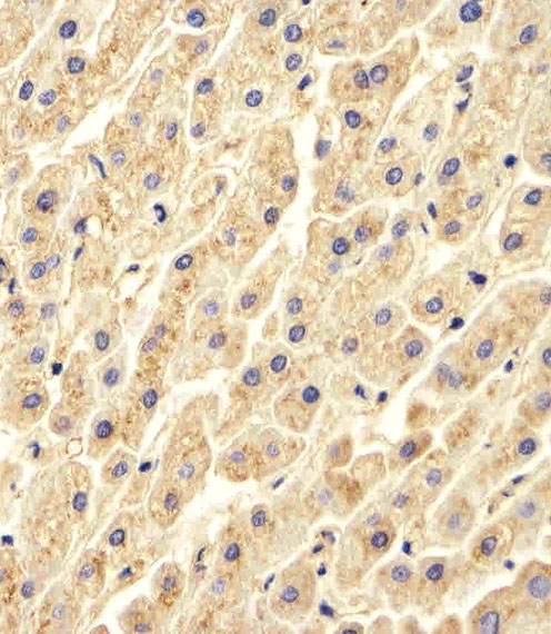 CTSD / Cathepsin D Antibody - Immunohistochemical of paraffin-embedded H.liver section using CTSD. Antibody was diluted at 1:25 dilution. A peroxidase-conjugated goat anti-rabbit IgG at 1:400 dilution was used as the secondary antibody, followed by DAB staining.