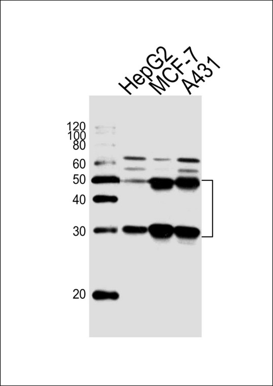 CTSD / Cathepsin D Antibody - Western blot of lysates from HepG2, MCF-7, A431 cell line (from left to right) with CTSD Antibody. Antibody was diluted at 1:1000 at each lane. A goat anti-rabbit IgG H&L (HRP) at 1:5000 dilution was used as the secondary antibody. Lysates at 35 ug per lane.