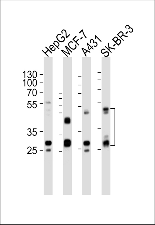 CTSD / Cathepsin D Antibody - Western blot of lysates from HepG2, MCF-7, A431, SK-BR-3 cell line (from left to right) with CTSD Antibody. Antibody was diluted at 1:1000 at each lane. A goat anti-rabbit IgG H&L (HRP) at 1:5000 dilution was used as the secondary antibody. Lysates at 35 ug per lane.