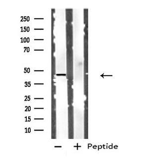 CTSD / Cathepsin D Antibody - Western blot analysis of extracts of HeLa cells using CTSD antibody.