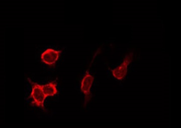 CTSD / Cathepsin D Antibody - Staining HeLa cells by IF/ICC. The samples were fixed with PFA and permeabilized in 0.1% Triton X-100, then blocked in 10% serum for 45 min at 25°C. The primary antibody was diluted at 1:200 and incubated with the sample for 1 hour at 37°C. An Alexa Fluor 594 conjugated goat anti-rabbit IgG (H+L) Ab, diluted at 1/600, was used as the secondary antibody.