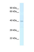 CTSE / Cathepsin E Antibody - CTSE / Cathepsin E antibody Western blot of Placenta lysate. Antibody concentration 1 ug/ml.  This image was taken for the unconjugated form of this product. Other forms have not been tested.