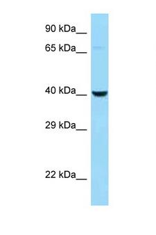 CTSE / Cathepsin E Antibody - CTSE / Cathepsin E antibody Western blot of H226 Cell lysate. Antibody concentration 1 ug/ml.  This image was taken for the unconjugated form of this product. Other forms have not been tested.