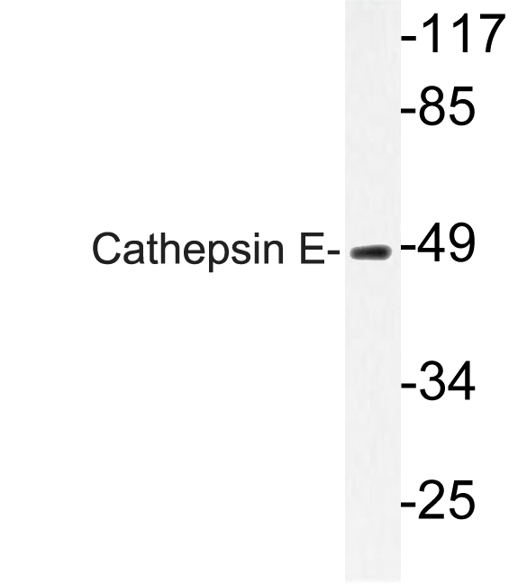 CTSE / Cathepsin E Antibody - Western blot of Cathepsin E (I292) pAb in extracts from HUVEC cells.