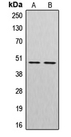 CTSE / Cathepsin E Antibody - Western blot analysis of Cathepsin E expression in HepG2 (A); HUVEC (B) whole cell lysates.