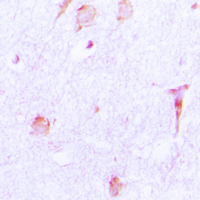 CTSE / Cathepsin E Antibody - Immunohistochemical analysis of Cathepsin E staining in human brain formalin fixed paraffin embedded tissue section. The section was pre-treated using heat mediated antigen retrieval with sodium citrate buffer (pH 6.0). The section was then incubated with the antibody at room temperature and detected using an HRP conjugated compact polymer system. DAB was used as the chromogen. The section was then counterstained with hematoxylin and mounted with DPX.