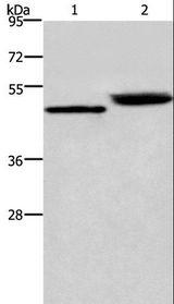 CTSE / Cathepsin E Antibody - Western blot analysis of Human stomach cancer and mouse stomach tissue, using CTSE Polyclonal Antibody at dilution of 1:450.