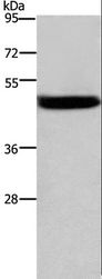 CTSE / Cathepsin E Antibody - Western blot analysis of Mouse stomach tissue, using CTSE Polyclonal Antibody at dilution of 1:525.