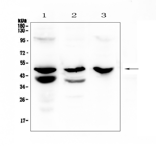 CTSE / Cathepsin E Antibody - Western blot analysis of Cathepsin E using anti-Cathepsin E antibody. Electrophoresis was performed on a 5-20% SDS-PAGE gel at 70V (Stacking gel) / 90V (Resolving gel) for 2-3 hours. The sample well of each lane was loaded with 50ug of sample under reducing conditions. Lane 1: rat stomach tissue lysates, Lane 2: mouse stomach tissue lysates, Lane 3: mouse SP20 whole cell lysates. After Electrophoresis, proteins were transferred to a Nitrocellulose membrane at 150mA for 50-90 minutes. Blocked the membrane with 5% Non-fat Milk/ TBS for 1.5 hour at RT. The membrane was incubated with rabbit anti-Cathepsin E antigen affinity purified polyclonal antibody at 0.5 ?g/mL overnight at 4?C, then washed with TBS-0.1% Tween 3 times with 5 minutes each and probed with a goat anti-rabbit IgG-HRP secondary antibody at a dilution of 1:10000 for 1.5 hour at RT. The signal is developed using an Enhanced Chemiluminescent detection (ECL) kit with Tanon 5200 system. A specific band was detected for Cathepsin E at approximately 48KD. The expected band size for Cathepsin E is at 43KD.