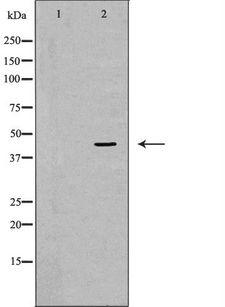 CTSE / Cathepsin E Antibody - Western blot analysis of extracts of MGC-803 using CTSE antibody. The lane on the left is treated with the antigen-specific peptide.