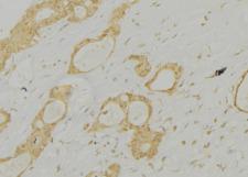 CTSE / Cathepsin E Antibody - 1:100 staining human lung tissue by IHC-P. The sample was formaldehyde fixed and a heat mediated antigen retrieval step in citrate buffer was performed. The sample was then blocked and incubated with the antibody for 1.5 hours at 22°C. An HRP conjugated goat anti-rabbit antibody was used as the secondary.