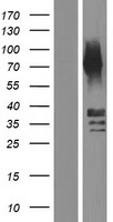 CTSE / Cathepsin E Protein - Western validation with an anti-DDK antibody * L: Control HEK293 lysate R: Over-expression lysate