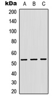 CTSF / Cathepsin F Antibody - Western blot analysis of Cathepsin F expression in HEK293T (A); Raw264.7 (B); H9C2 (C) whole cell lysates.