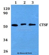 CTSF / Cathepsin F Antibody - Western blot of CTSF antibody at 1:500 dilution. Lane 1: HEK293T whole cell lysate. Lane 2: Raw264.7 whole cell lysate. Lane 3: H9C2 whole cell lysate.