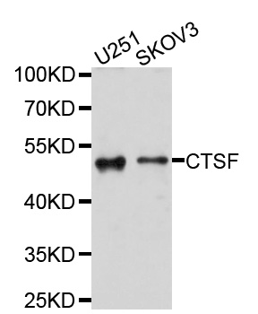 CTSF / Cathepsin F Antibody - Western blot analysis of extracts of various cell lines, using CTSF antibody at 1:1000 dilution. The secondary antibody used was an HRP Goat Anti-Rabbit IgG (H+L) at 1:10000 dilution. Lysates were loaded 25ug per lane and 3% nonfat dry milk in TBST was used for blocking. An ECL Kit was used for detection and the exposure time was 1s.