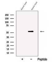 CTSF / Cathepsin F Antibody - Western blot analysis of extracts of mouse brain tissue using CathepsinF antibody. The lane on the left was treated with blocking peptide.