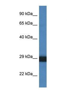 CTSG / Cathepsin G Antibody - CTSG / Cathepsin G antibody Western blot of 1 Cell lysate. Antibody concentration 1 ug/ml.  This image was taken for the unconjugated form of this product. Other forms have not been tested.