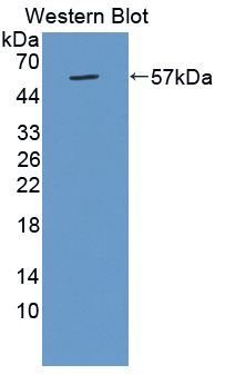 CTSG / Cathepsin G Antibody - Western blot of CTSG / Cathepsin G antibody.