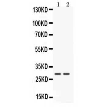 CTSG / Cathepsin G Antibody - Western blot analysis of Cathepsin G expression in mouse liver extract (lane 1) and mouse kidney extract (lane 2). Cathepsin G at 29 kD was detected using rabbit anti- Cathepsin G Antigen Affinity purified polyclonal antibody at 0.5 ug/mL. The blot was developed using chemiluminescence (ECL) method.