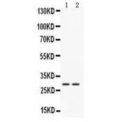 CTSG / Cathepsin G Antibody - Western blot analysis of Cathepsin G expression in mouse liver extract (lane 1) and mouse kidney extract (lane 2). Cathepsin G at 29 kD was detected using rabbit anti- Cathepsin G Antigen Affinity purified polyclonal antibody at 0.5 ug/mL. The blot was developed using chemiluminescence (ECL) method.