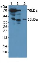 CTSG / Cathepsin G Antibody - Western Blot; Sample: Lane1: Rat Serum; Lane2: Rat Heart Tissue; Lane3: Human MCF7 Cells.