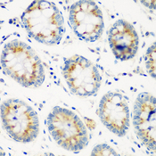CTSG / Cathepsin G Antibody - Immunohistochemistry of paraffin-embedded human colon tissue.