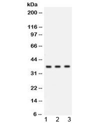 CTSG / Cathepsin G Antibody - Western blot testing of human 1) COLO320, 2) MCF7 and 3) U-2 OS lysate with Cathepsin G antibody at 0.5ug/ml. Predicted molecular weight ~29 kDa, can be observed at ~36 kDa.