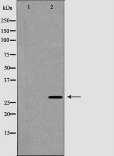 CTSG / Cathepsin G Antibody - Western blot analysis of Cathepsin G expression in COLO cells. The lane on the left is treated with the antigen-specific peptide.