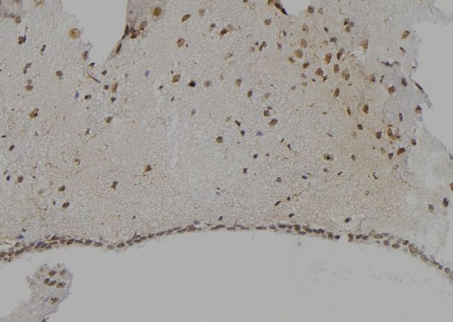 CTSG / Cathepsin G Antibody - 1:100 staining mouse brain tissue by IHC-P. The sample was formaldehyde fixed and a heat mediated antigen retrieval step in citrate buffer was performed. The sample was then blocked and incubated with the antibody for 1.5 hours at 22°C. An HRP conjugated goat anti-rabbit antibody was used as the secondary.