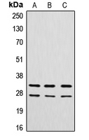 CTSG / Cathepsin G Antibody - Western blot analysis of Cathepsin G expression in A549 (A); MCF7 (B); rat heart (C) whole cell lysates.