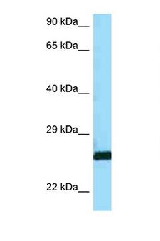 CTSH / Cathepsin H Antibody - CTSH / Cathepsin H antibody Western blot of A549 Cell lysate. Antibody concentration 1 ug/ml.  This image was taken for the unconjugated form of this product. Other forms have not been tested.