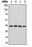 CTSH / Cathepsin H Antibody - Western blot analysis of Cathepsin H expression in Jurkat (A); K562 (B); mouse kidney (C); PC12 (D) whole cell lysates.