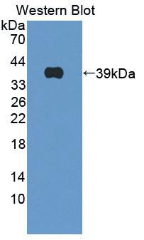 CTSH / Cathepsin H Antibody - Western Blot; Sample: Recombinant protein.
