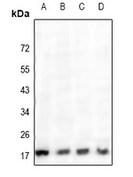 CTSH / Cathepsin H Antibody - Western blot analysis of Cathepsin H expression in PC3 (A), HepG2 (B), A549 (C), MCF7 (D) whole cell lysates.