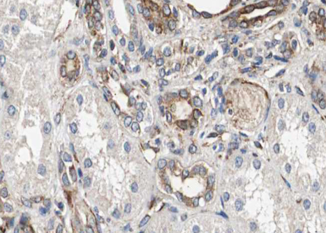 CTSH / Cathepsin H Antibody - 1:100 staining human kidney tissue by IHC-P. The sample was formaldehyde fixed and a heat mediated antigen retrieval step in citrate buffer was performed. The sample was then blocked and incubated with the antibody for 1.5 hours at 22°C. An HRP conjugated goat anti-rabbit antibody was used as the secondary.