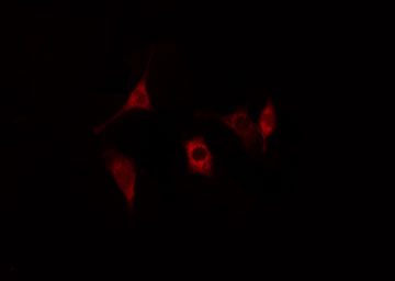 CTSH / Cathepsin H Antibody - Staining HeLa cells by IF/ICC. The samples were fixed with PFA and permeabilized in 0.1% Triton X-100, then blocked in 10% serum for 45 min at 25°C. The primary antibody was diluted at 1:200 and incubated with the sample for 1 hour at 37°C. An Alexa Fluor 594 conjugated goat anti-rabbit IgG (H+L) antibody, diluted at 1/600, was used as secondary antibody.